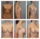 Before & After photo of Breast Augmentation
